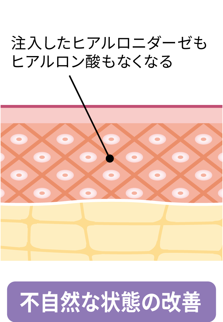 3.不自然な状態の改善